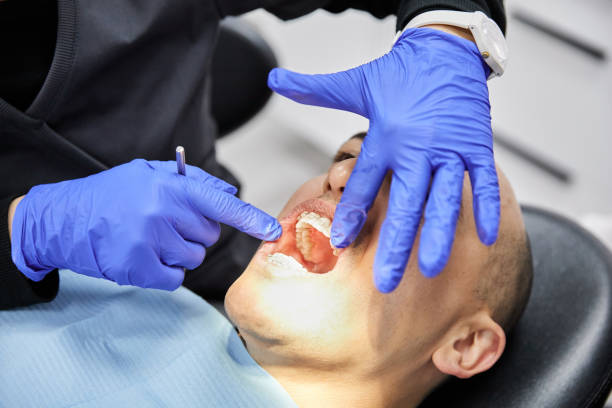 Best Emergency Dentist for Knocked-Out Tooth in Harkers Island, NC