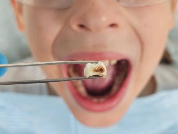 Best Holiday Emergency Dentist in Harkers Island, NC